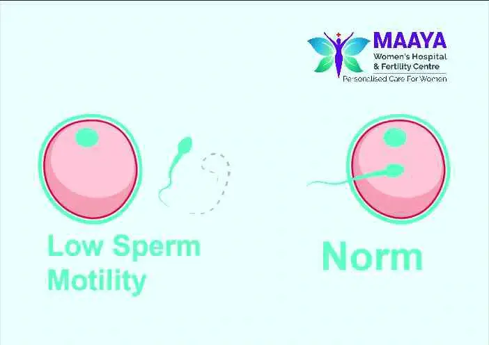Not getting pregnant?It may be due to low sperm count also!!!
